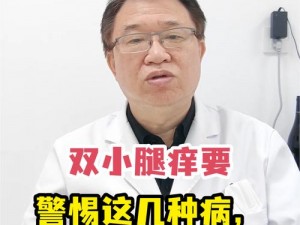 淑芬两腿间又痒痒的预防方法、如何预防淑芬两腿间又痒痒？