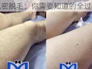 私密脱毛：你需要知道的全过程