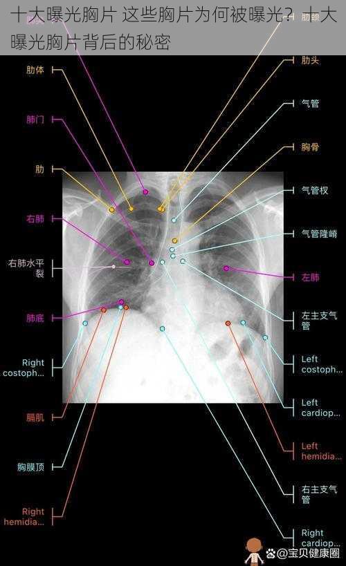 十大曝光胸片 这些胸片为何被曝光？十大曝光胸片背后的秘密